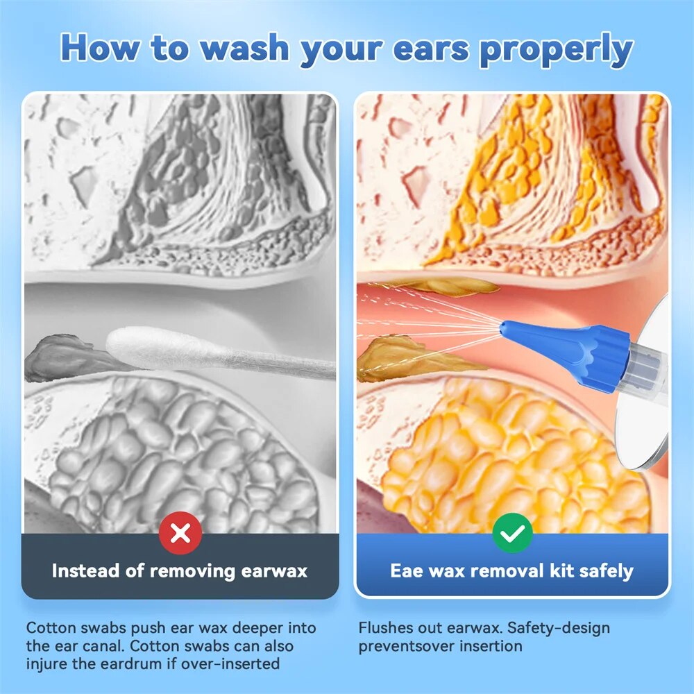 Ear Wax Removal Manual Ear Cle - Smart Garden Watering System ulasan dan harga