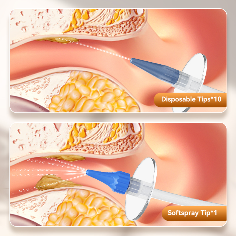 Ear Wax Removal Manual Ear Irr - Smart Garden Watering System ulasan dan harga